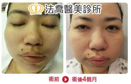 法喬醫美診所 邱浚彥醫師