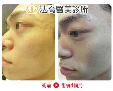 法喬醫美診所 邱浚彥醫師