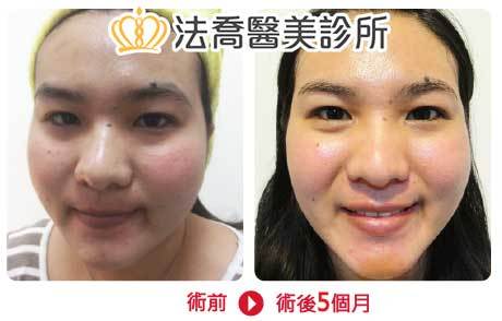法喬醫美診所 邱浚彥醫師