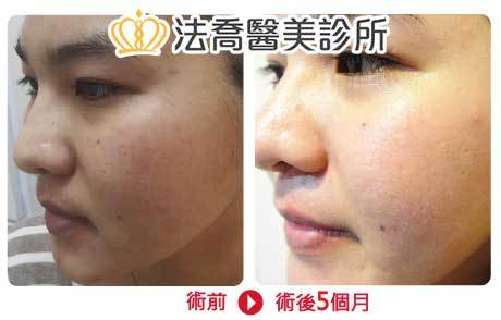 法喬醫美診所 邱浚彥醫師