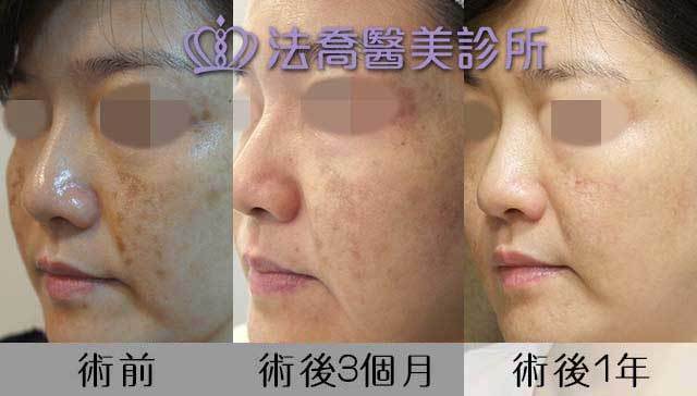 法喬醫美診所 邱浚彥醫師