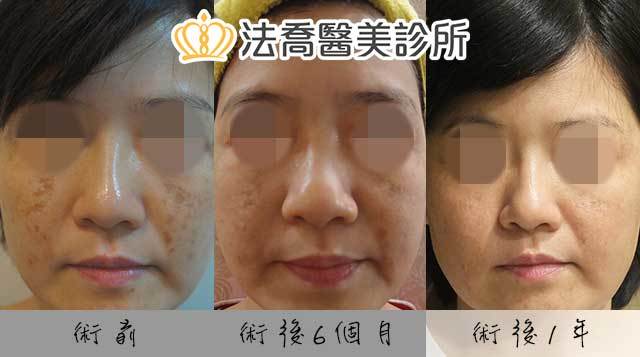 法喬醫美診所 邱浚彥醫師