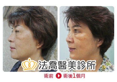 法喬醫美診所 邱浚彥醫師