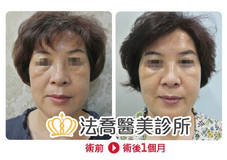 法喬醫美診所 邱浚彥醫師