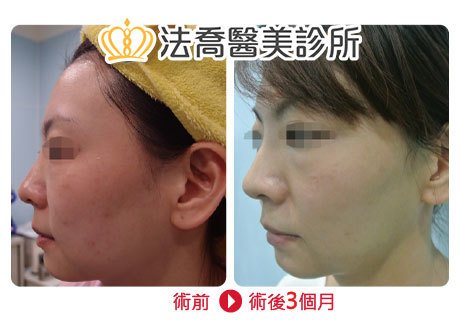 法喬醫美診所 邱浚彥醫師