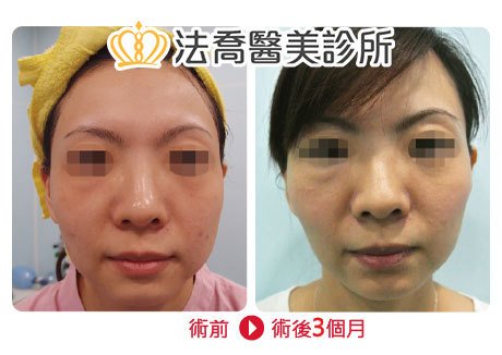 法喬醫美診所 邱浚彥醫師