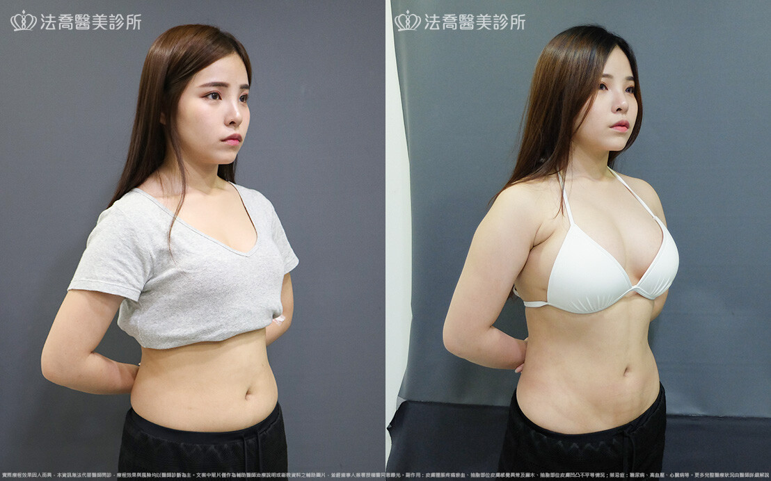 威塑Vaser