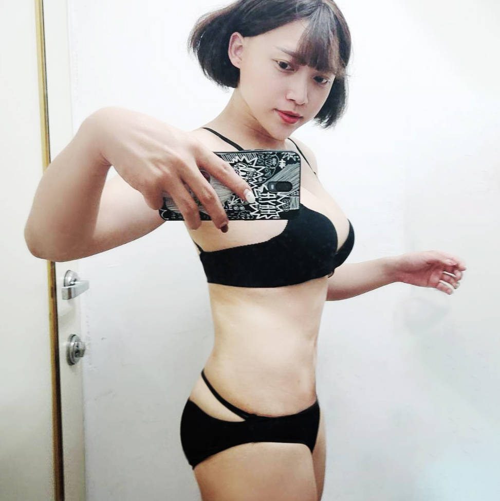 威塑豐胸補脂術後45天