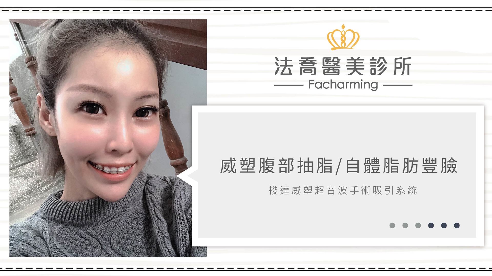高雄法喬醫美,邱浚彥,張慈恩,威塑抽脂