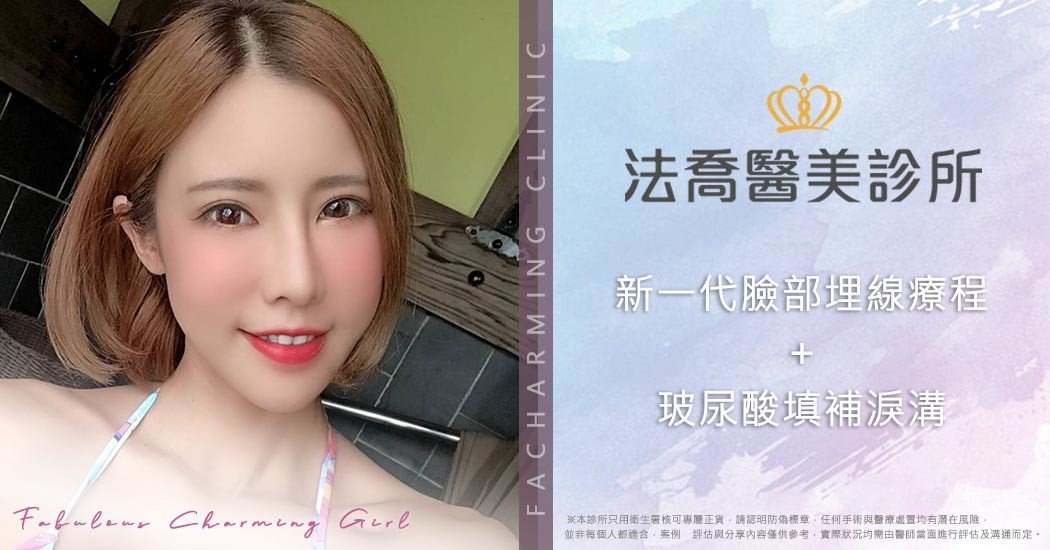 法喬醫美診所藍鑽魚骨線埋線拉提術後2周案例照