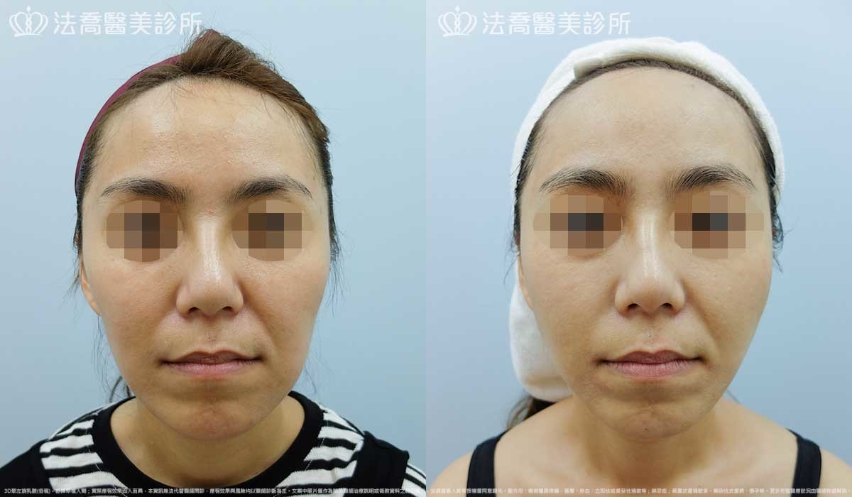 法喬醫美診所,邱浚彥,張慈恩