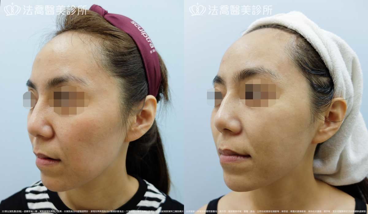 法喬醫美診所,邱浚彥,張慈恩