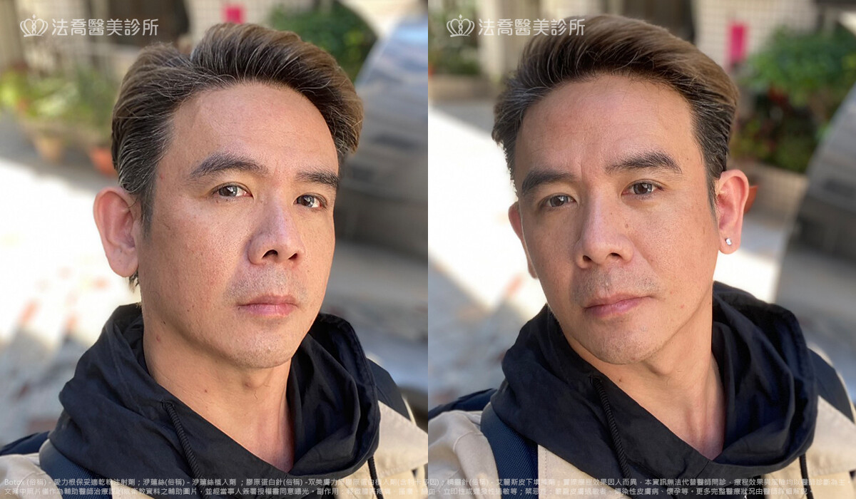 法喬醫美診所,邱浚彥,張慈恩