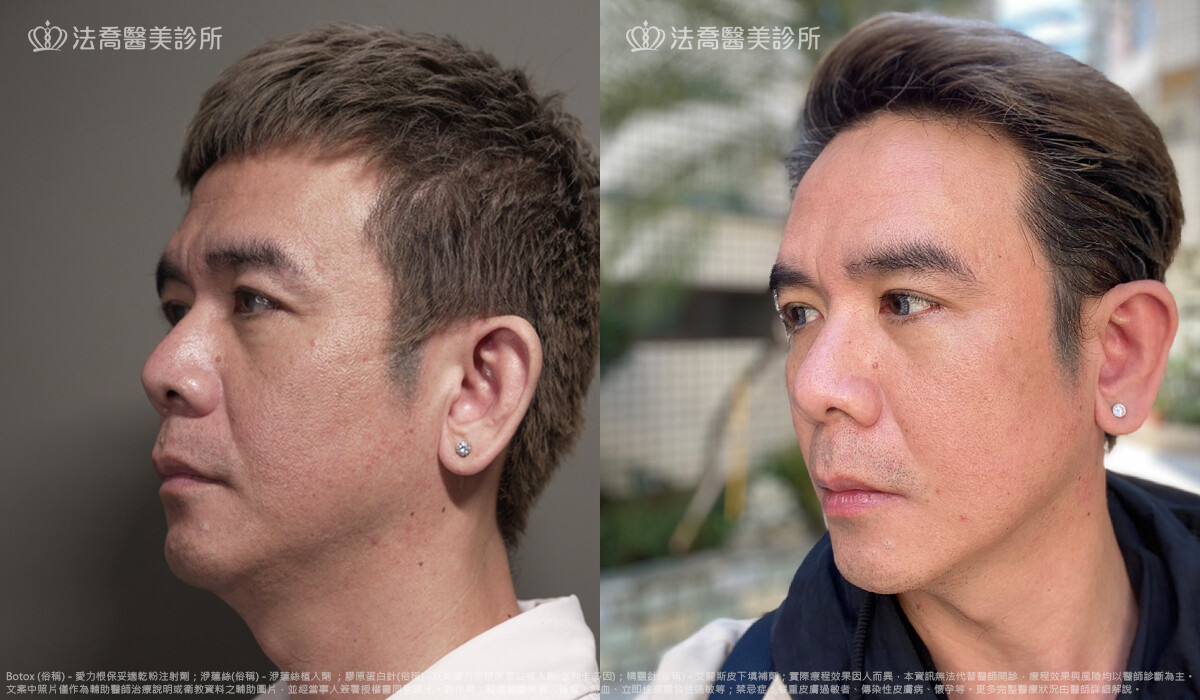 法喬醫美診所,邱浚彥,張慈恩
