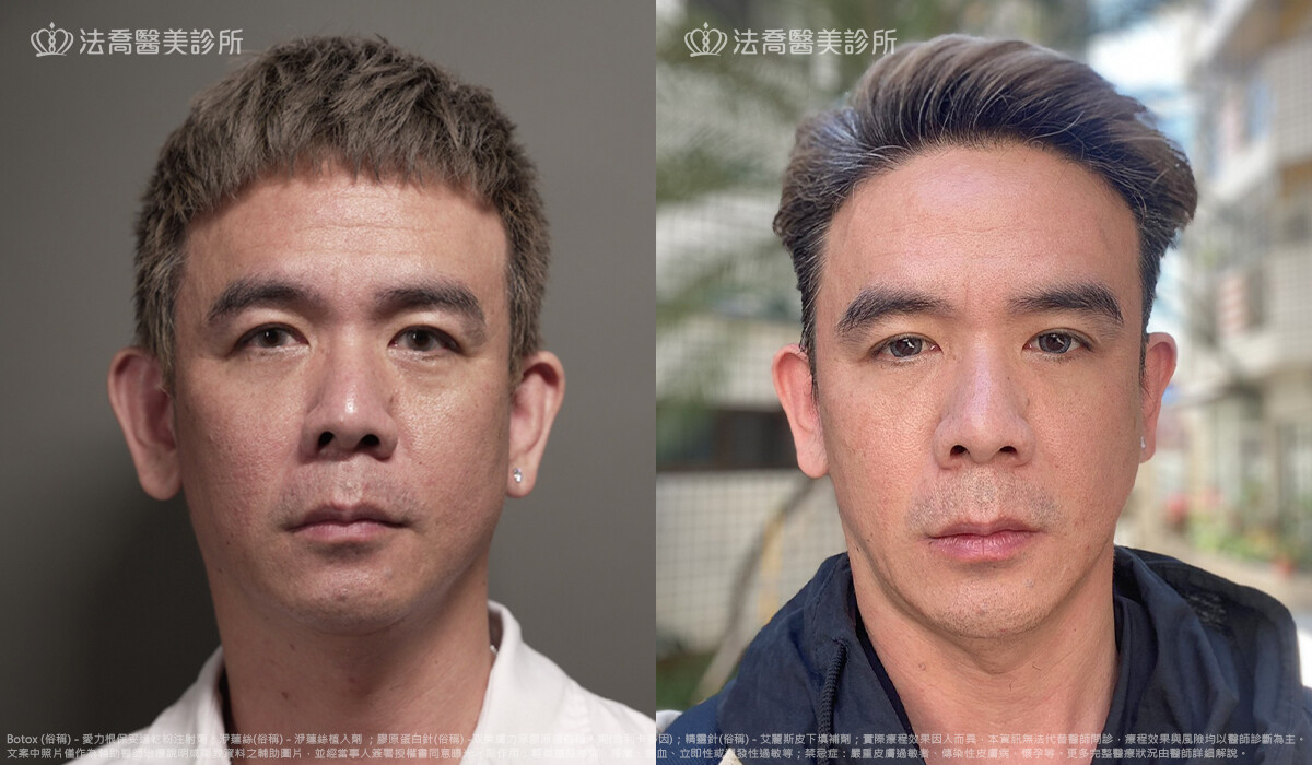 法喬醫美診所,邱浚彥,張慈恩