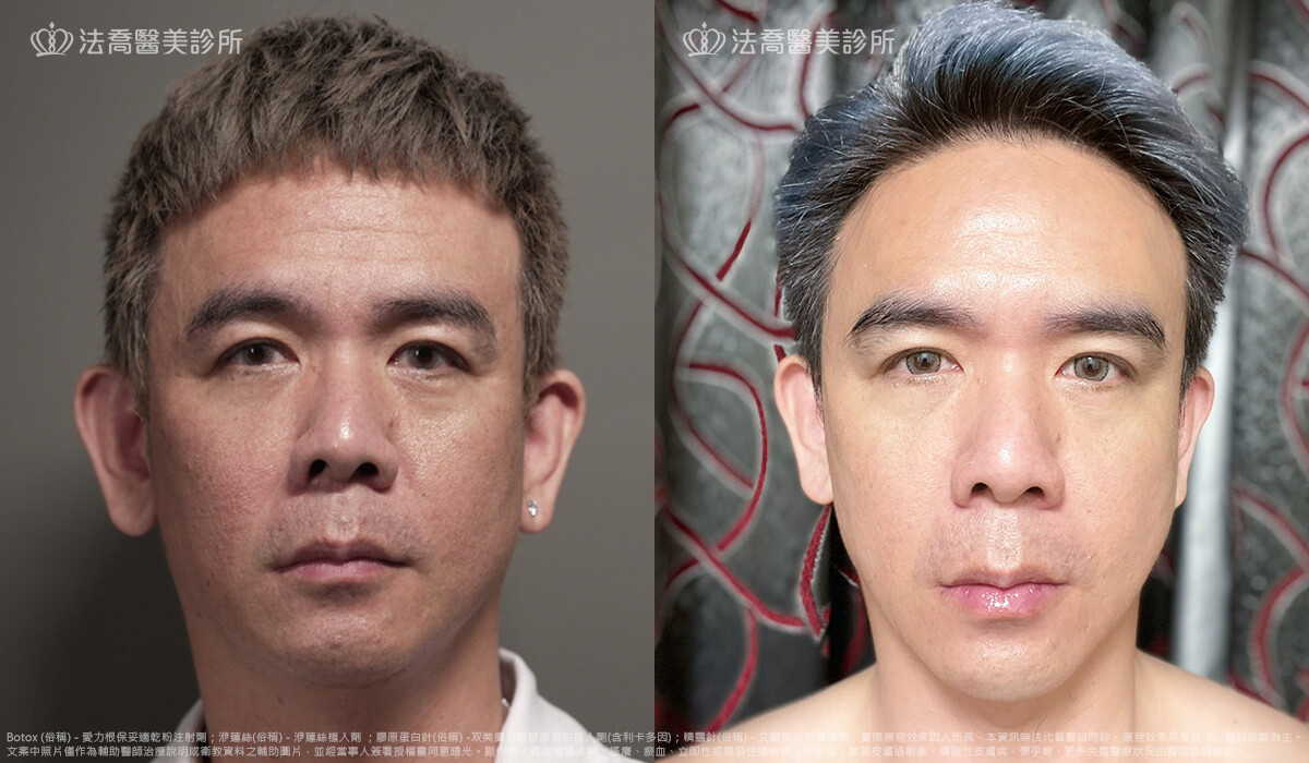 法喬醫美診所,邱浚彥,張慈恩