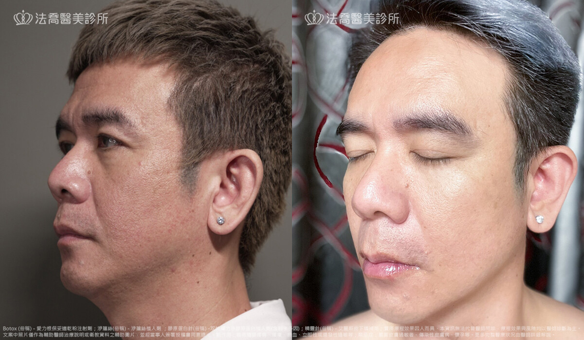 法喬醫美診所,邱浚彥,張慈恩