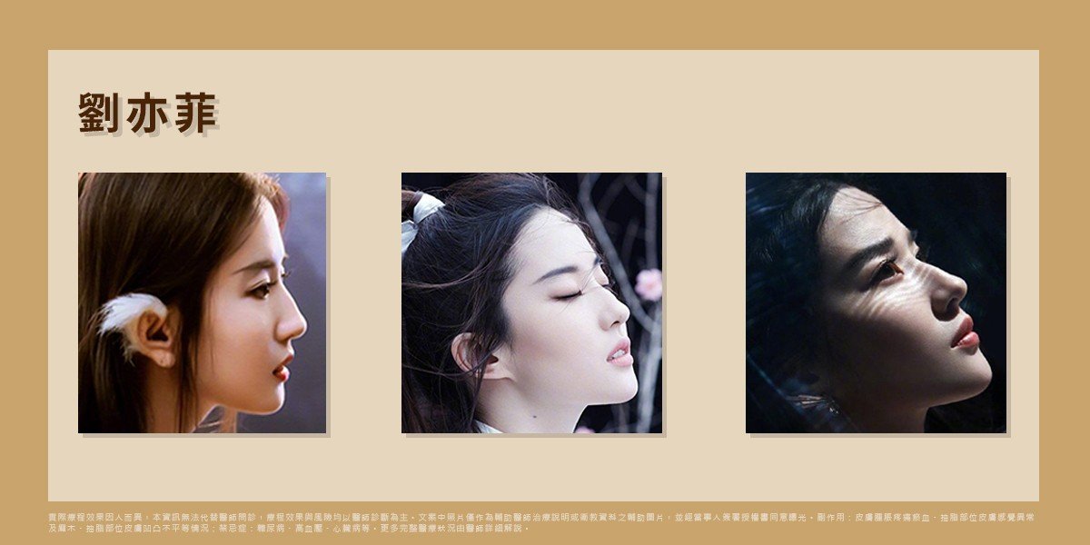 劉亦菲的駝峰鼻