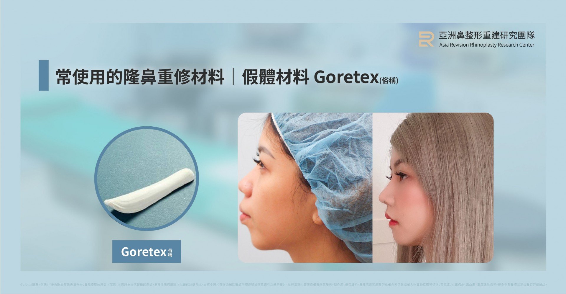 台北高雄二次隆鼻法喬邱浚彥